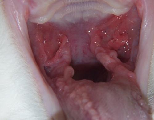 Gingivostomatitis