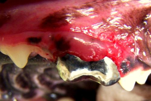 Metal crown on upper 4th premolar